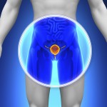 Laser per il trattamento del tumore prostatico. Al via studio a Tor Vergata