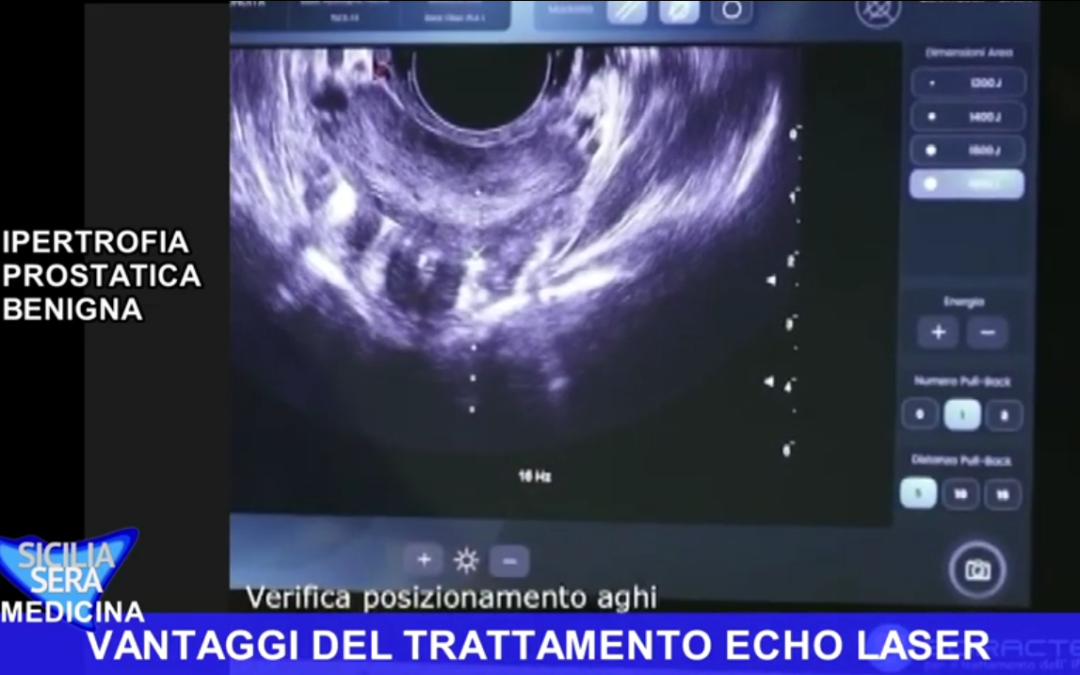 SICILIA SERA – IPERTROFIA PROSTATICA BENIGNA E TUMORE DELLA PROSTATA: RISCHI E CURE